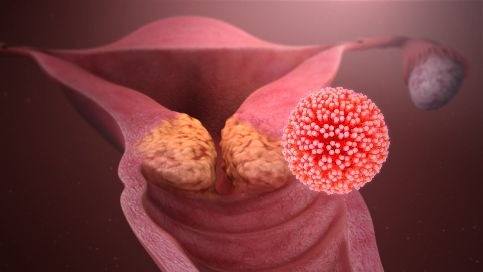 Oggi la Giornata mondiale contro il Papillomavirus (HPV)
